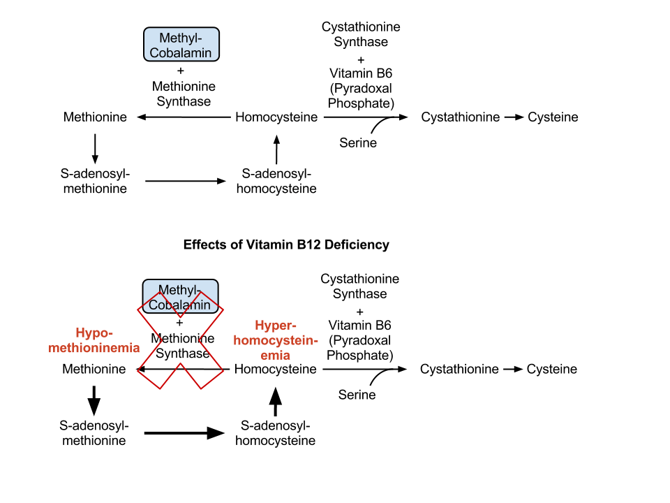 Cobalamin deficiency Vitamin B12 and methionine synthesis