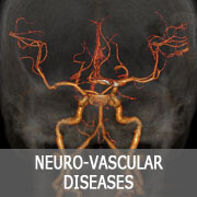 Neurovascular disorders