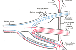 A typical spinal nerve root showing the dorsal root ganglion ("spinal ganglion" in posterior nerve root in the terminology of Henry Gray).