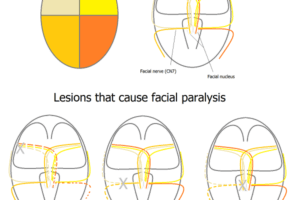 Central and peripheral facial nerve pathway